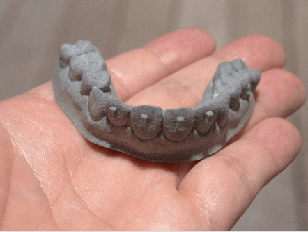 3Dプリンターで作られた歯形モデル